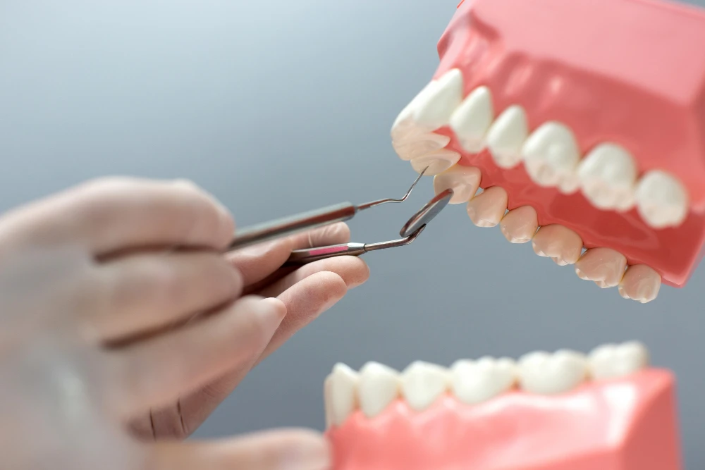 dental bridge vs implant - Which tooth replacement is best