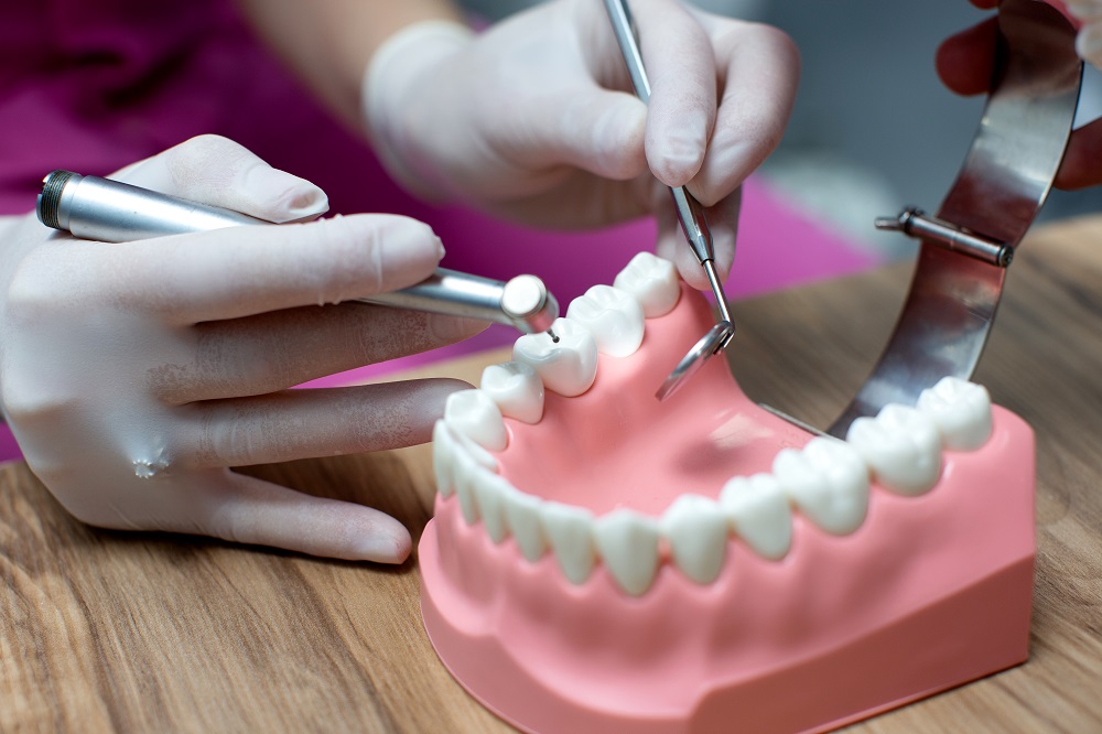 Dental Crowns