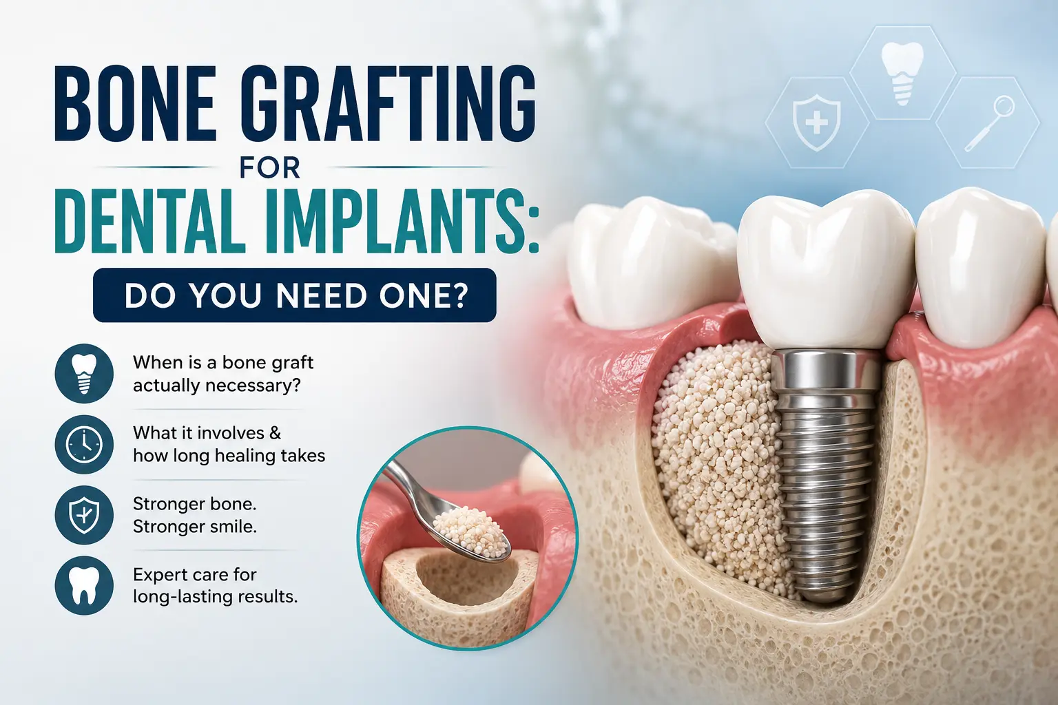 dental bone graft