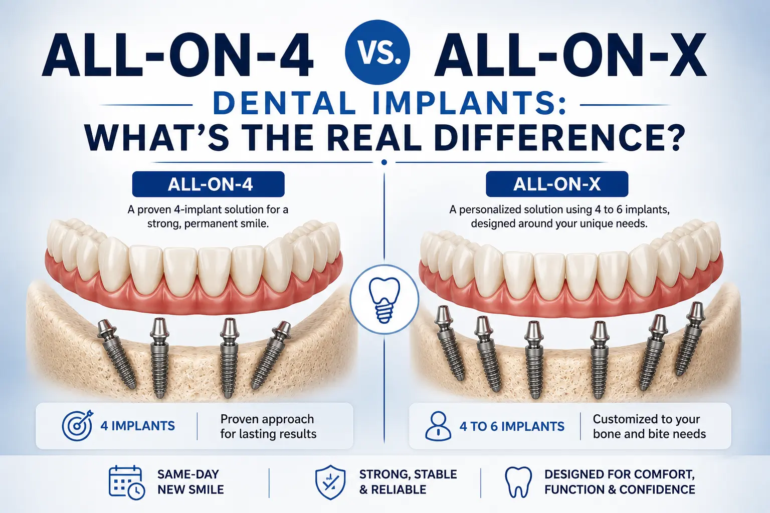 All-on-4 vs. All-on-X